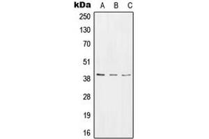 Western blot analysis of RPC expression in HeLa (A), NIH3T3 (B), rat stomach (C) whole cell lysates. (RTCD1 antibody  (C-Term))