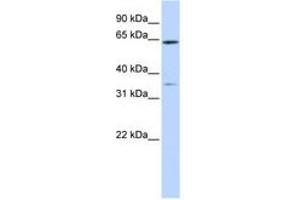 Image no. 1 for anti-Tripartite Motif Containing 45 (TRIM45) (AA 396-445) antibody (ABIN6740818) (TRIM45 antibody  (AA 396-445))