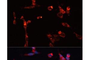 Immunofluorescence analysis of NIH/3T3 cells using MMP16 Polyclonal Antibody at dilution of 1:100. (MMP16 antibody)