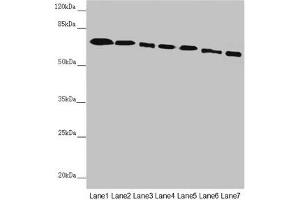 Western blot All lanes: DYNC1I1 antibody at 2.