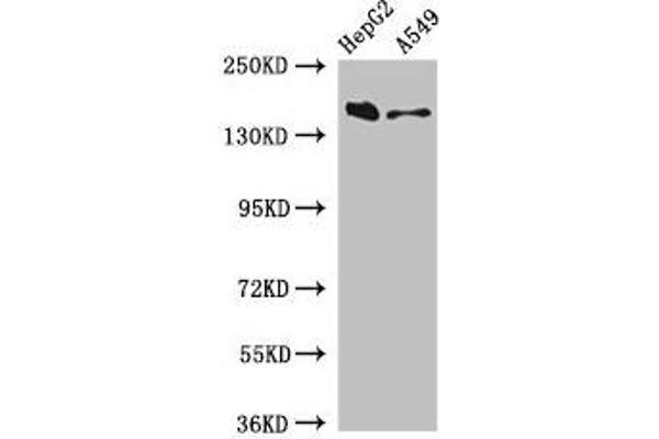 DOT1L anticorps  (AA 331-484)