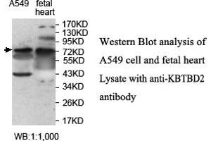 Image no. 1 for anti-Kelch Repeat and BTB (POZ) Domain Containing 2 (KBTBD2) antibody (ABIN1577433) (KBTBD2 antibody)