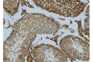 ABIN6275477 at 1/100 staining Mouse testis tissue by IHC-P.