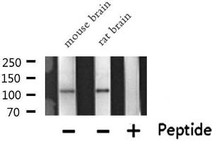Western blot analysis of PKN1/PRK1 expression in various lysates (PKN1 antibody  (Internal Region))