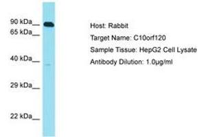 Image no. 1 for anti-Chromosome 10 Open Reading Frame 120 (C10ORF120) (AA 223-272) antibody (ABIN6750814) (C10ORF120 antibody  (AA 223-272))