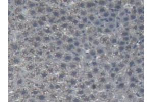 IHC-P analysis of Rat Liver Tissue, with DAB staining. (AGT antibody)