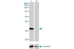 Western blot analysis of DGUOK over-expressed 293 cell line, cotransfected with DGUOK Validated Chimera RNAi (Lane 2) or non-transfected control (Lane 1). (Deoxyguanosine Kinase antibody  (AA 1-89))