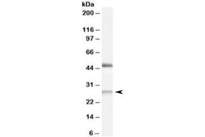 Western blot testing of human kidney lysate with BNIP1 antibody at 0. (BNIP1 antibody)