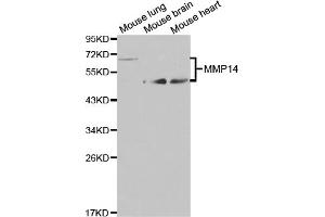 Western blot analysis of extracts of various cell lines, using MMP14 antibody (ABIN5971375) at 1/1000 dilution. (MMP14 antibody)