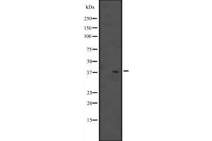 Western blot analysis of MUL1 expression in A431 whole cell lysate ,The lane on the left is treated with the antigen-specific peptide.