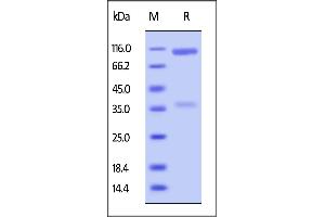 Biotinylated Human LILRB2, Fc,Avitag on  under reducing (R) condition. (LILRB2 Protein (AA 22-461) (Fc Tag,AVI tag,Biotin))