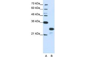 WB Suggested Anti-ANP32A Antibody Titration:  1. (PHAP1 antibody  (N-Term))