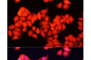 Immunofluorescence analysis of HeLa cells using ARAF Polyclonal Antibody at dilution of 1:100. (ARAF antibody)
