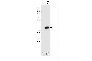 Western blot analysis of AKR1B1 using rabbit polyclonal AKR1B1 Antibody using 293 cell lysates (2 ug/lane) either nontransfected (Lane 1) or transiently transfected (Lane 2) with the AKR1B1 gene. (AKR1B1 antibody  (AA 102-135))