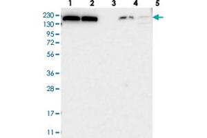 Western blot analysis of Lane 1: RT-4, Lane 2: U-251 MG, Lane 3: Human Plasma, Lane 4: Liver, Lane 5: Tonsil with KIAA1462 polyclonal antibody  at 1:250-1:500 dilution. (JCAD/KIAA1462 antibody)