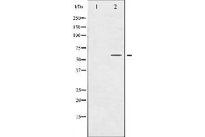 Western blot analysis of Tyrosine Hydroxylase phosphorylation expression in UV treated 293 whole cell lysates,The lane on the left is treated with the antigen-specific peptide. (Tyrosine Hydroxylase antibody  (pSer31))