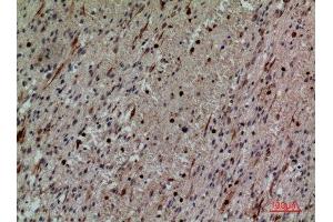 Immunohistochemistry (IHC) analysis of paraffin-embedded Human Brain, antibody was diluted at 1:100. (CD58 antibody  (Internal Region))