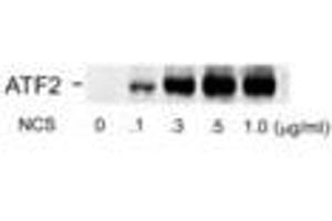 Image no. 1 for anti-Activating Transcription Factor 2 (ATF2) (pSer490), (Ser498) antibody (ABIN228488) (ATF2 antibody  (pSer490, Ser498))