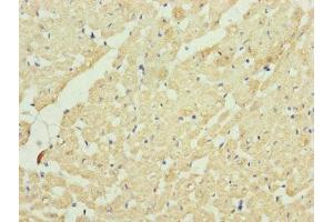 Immunohistochemistry of paraffin-embedded human heart tissue using ABIN7149107 at dilution of 1:100 (UQCRC2 antibody  (AA 224-453))