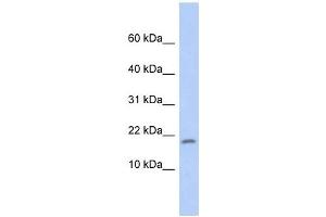 RPS15 antibody used at 1 ug/ml to detect target protein. (RPS15 antibody  (Middle Region))