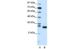 CDK5 antibody (20R-1201) used at 0. (CDK5 antibody  (N-Term))