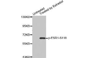 Western blot analysis of extracts from MDA cells using Phospho-ESR1-S118 antibody. (Estrogen Receptor alpha antibody  (pSer118))
