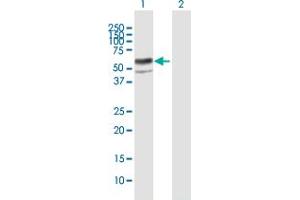 Western Blot analysis of ENTPD8 expression in transfected 293T cell line by ENTPD8 MaxPab polyclonal antibody.