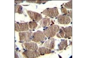 PION Antibody (C-term) (ABIN656412 and ABIN2845706) immunohistochemistry analysis in formalin fixed and paraffin embedded human skeletal muscle followed by peroxidase conjugation of the secondary antibody and DAB staining. (GSAP antibody  (C-Term))