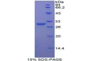 SDS-PAGE analysis of Human dNER Protein. (DNER Protein)