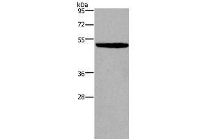 Western Blot analysis of NIH/3T3 cell using KCNN4 Polyclonal Antibody at dilution of 1:450 (KCNN4 antibody)