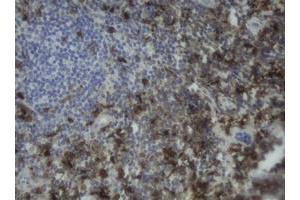 Image no. 1 for anti-Coagulation Factor XIII, A1 Polypeptide (F13A1) antibody (ABIN1498151)