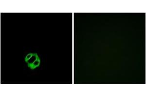 Immunofluorescence analysis of MCF7 cells, using AGTRL1 Antibody. (Apelin Receptor antibody  (AA 141-190))