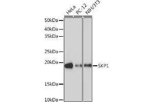 Western blot analysis of extracts of various cell lines, using SKP1 Rabbit mAb (ABIN7270120) at 1:1000 dilution. (SKP1 antibody)