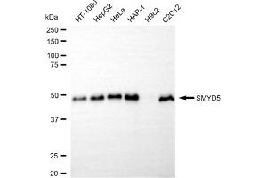 anti-SMYD Family Member 5 (SMYD5) antibody