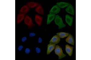 ABIN6259508 and ABIN6275584 staining Hela cells by IF/ICC.