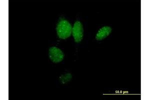 Immunofluorescence of purified MaxPab antibody to IRF2 on HeLa cell. (IRF2 antibody  (AA 1-349))