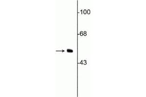 Western blot of HeLa cell lysate showing specific immunolabeling of the ~50 kDa vimentin protein. (Vimentin antibody)