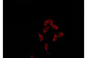 ABIN6274429 staining HepG2 by IF/ICC. (ACRBP antibody  (Internal Region))