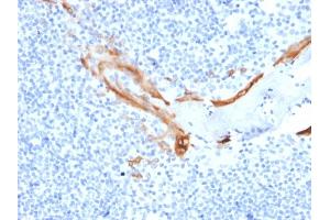 Formalin-fixed, paraffin-embedded human Tonsil stained with Cytokeratin 16 Mouse Monoclonal Antibody (SPM264).