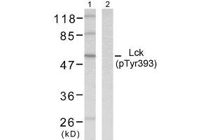 Western blot analysis of extracts from MOLT cells using Lck (phospho-Tyr393) antibody (E011144). (LCK antibody  (pTyr393))