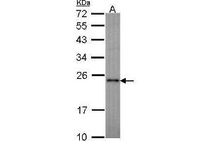 WB Image Sample (30 ug of whole cell lysate) A: Molt-4 , 12% SDS PAGE RAP1A antibody antibody diluted at 1:1000 (RAP1A antibody  (Center))