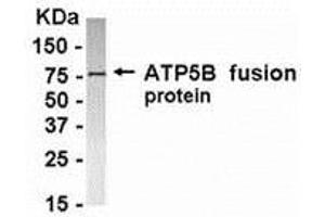 Western Blotting (WB) image for anti-ATP Synthase, H+ Transporting, Mitochondrial F1 Complex, beta Polypeptide (ATP5B) (AA 291-539) antibody (ABIN2468164) (ATP5B antibody  (AA 291-539))