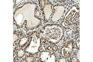 IHC analysis of SFPQ using anti-SFPQ antibody (ABIN7603089).