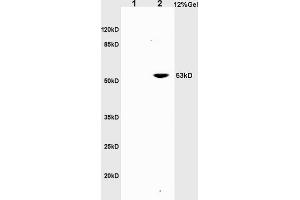 L1 rat brain lysates L2 rat liver lysates probed with Anti CD30/TNFRSF8/CD153 Polyclonal Antibody, Unconjugated (ABIN741090) at 1:200 in 4 °C. (TNFRSF8 antibody  (AA 131-230))