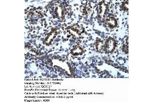 Human Lung (TGFB1I1 antibody  (Middle Region))