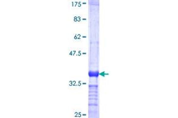 RNASE2 Protein (AA 86-161) (GST tag)