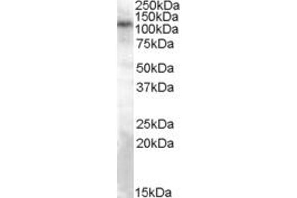 TRPC4 antibody  (Internal Region)