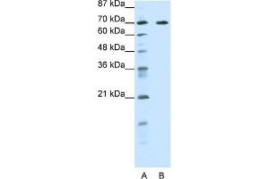 WB Suggested Anti-FOXK2 Antibody Titration:  0. (Forkhead Box K2 antibody  (Middle Region))