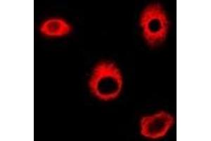 Immunofluorescent analysis of HAGH staining in A549 cells. (HAGH antibody)