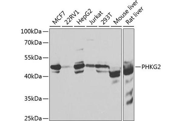 PHKG2 antibody  (AA 237-406)